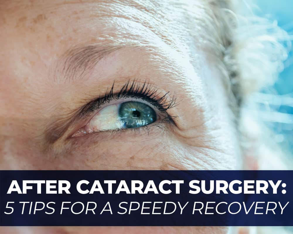 After Cataract Surgery