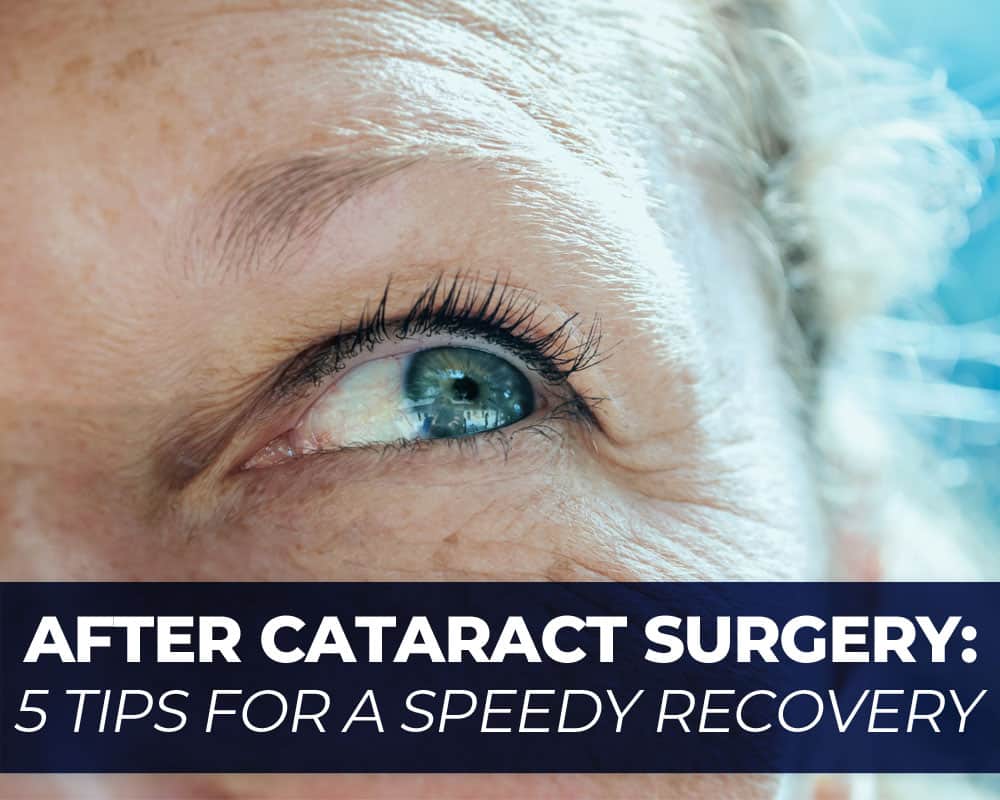 After Cataract Surgery 5 Tips For a Speedy Recovery Center for